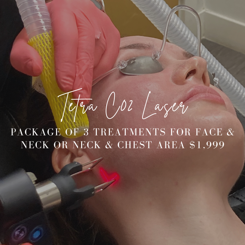 Tetra CO2 laser package - 3 treatments for $1999 on neck, chest, or face