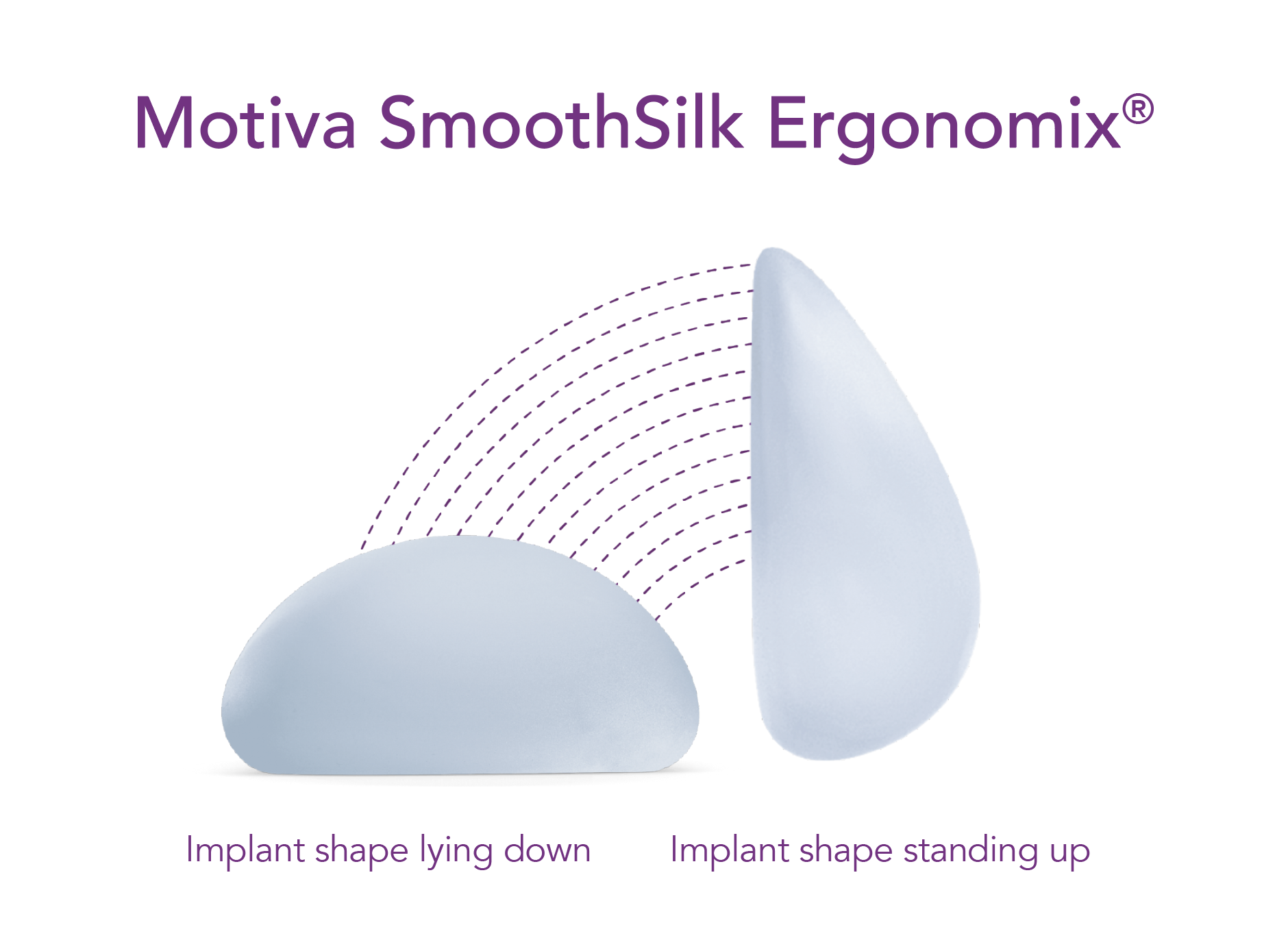 Motiva SmoothSilk Ergonomix shaped implants diagram