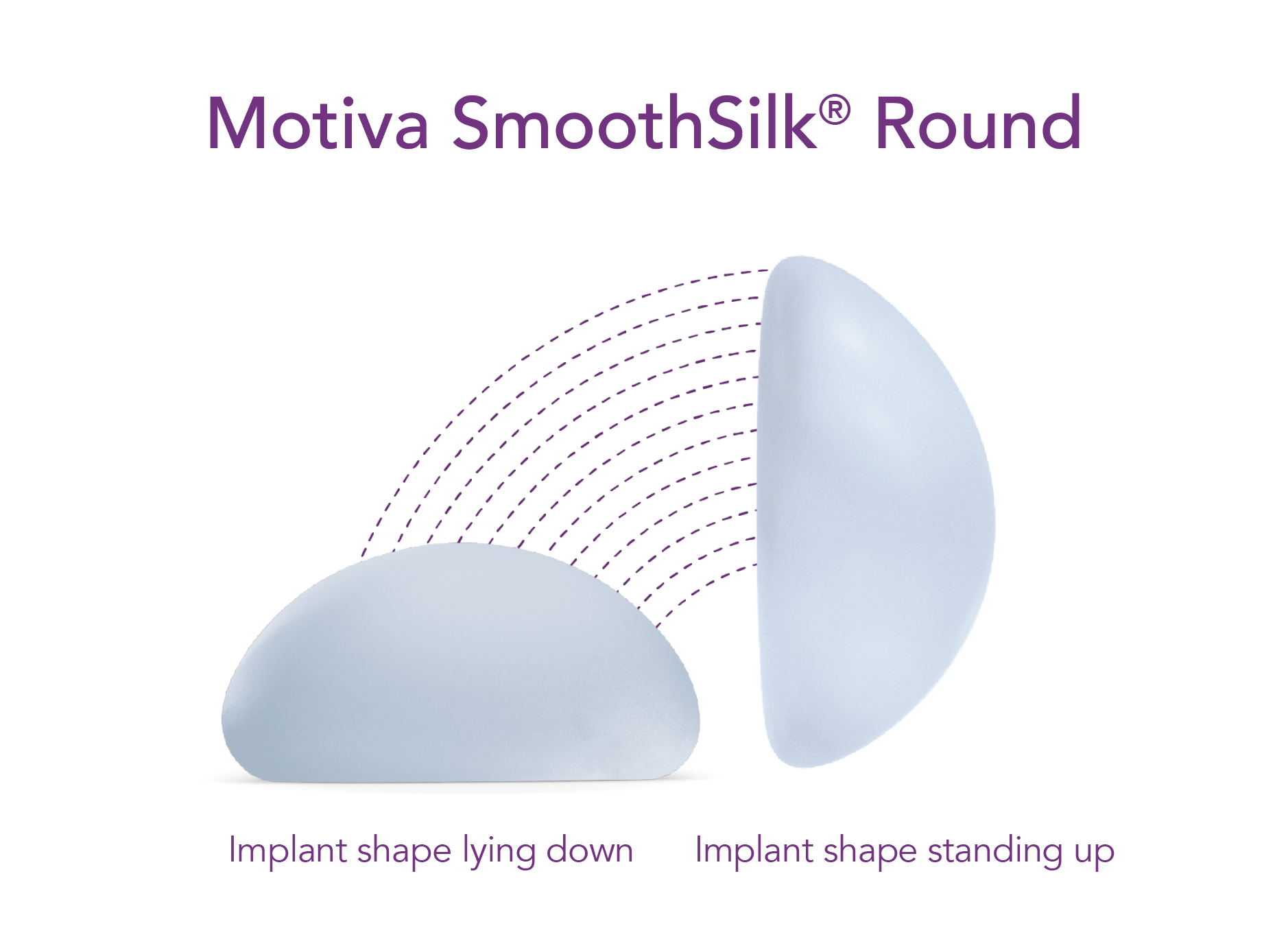 Motiva SmoothSilk Round round implants diagram