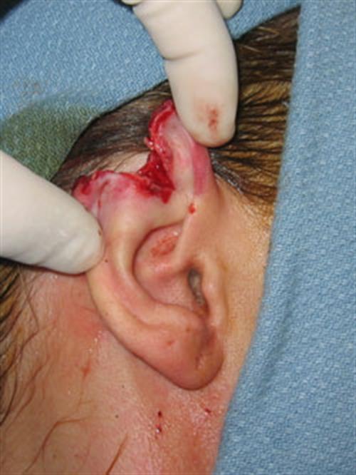 Facial & Body Reconstruction Before Photo | Phoenix and Scottsdale, AZ | Scottsdale Center for Plastic Surgery