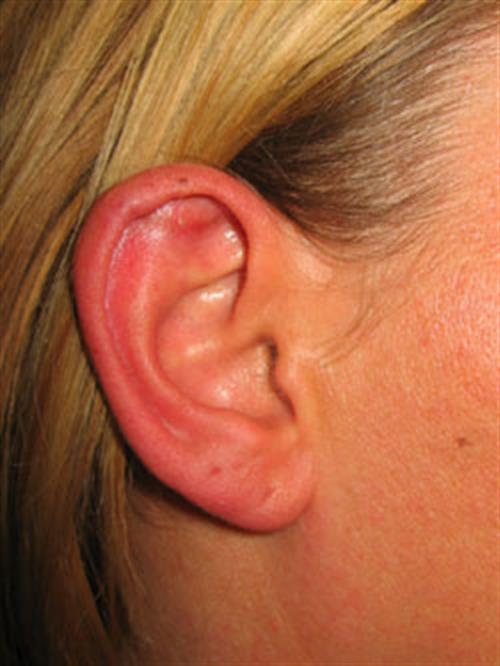 Facial & Body Reconstruction After Photo | Phoenix and Scottsdale, AZ | Scottsdale Center for Plastic Surgery
