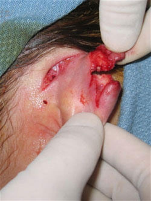 Facial & Body Reconstruction Before Photo | Phoenix and Scottsdale, AZ | Scottsdale Center for Plastic Surgery