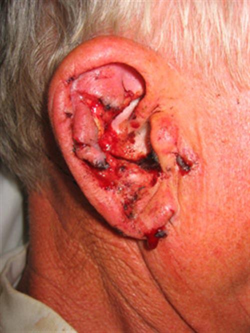 Facial & Body Reconstruction Before Photo | Phoenix and Scottsdale, AZ | Scottsdale Center for Plastic Surgery