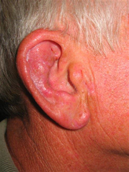 Facial & Body Reconstruction After Photo | Phoenix and Scottsdale, AZ | Scottsdale Center for Plastic Surgery