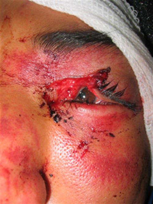 Facial & Body Reconstruction Before Photo | Phoenix and Scottsdale, AZ | Scottsdale Center for Plastic Surgery