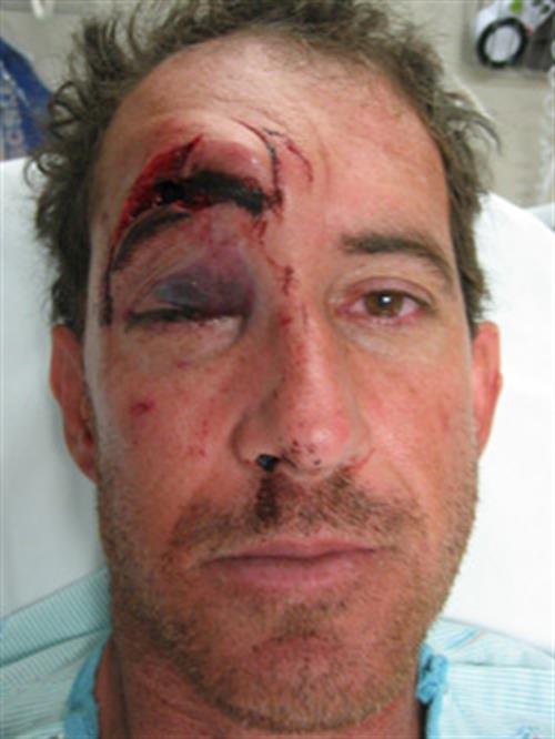Facial & Body Reconstruction Before Photo | Phoenix and Scottsdale, AZ | Scottsdale Center for Plastic Surgery