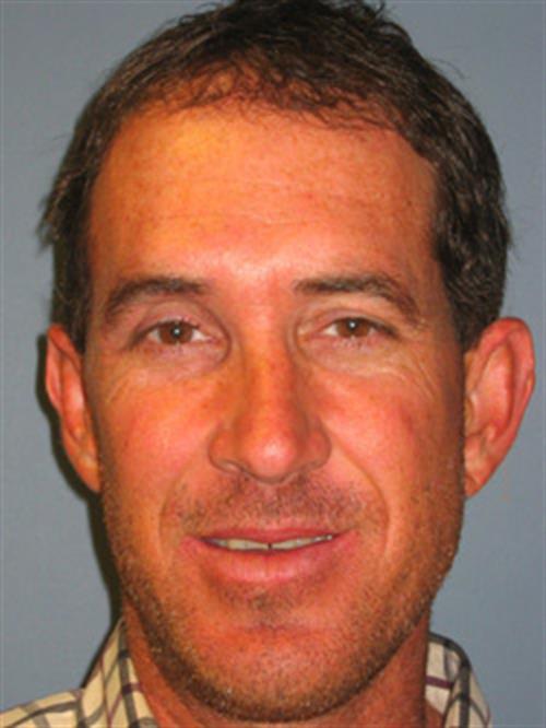 Facial & Body Reconstruction After Photo | Phoenix and Scottsdale, AZ | Scottsdale Center for Plastic Surgery
