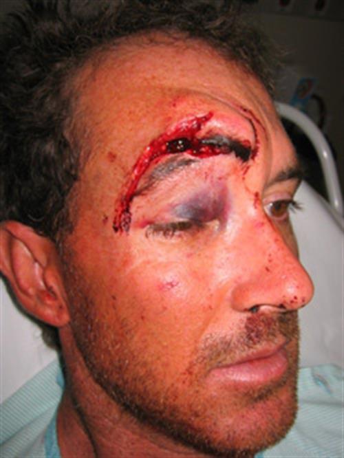 Facial & Body Reconstruction Before Photo | Phoenix and Scottsdale, AZ | Scottsdale Center for Plastic Surgery