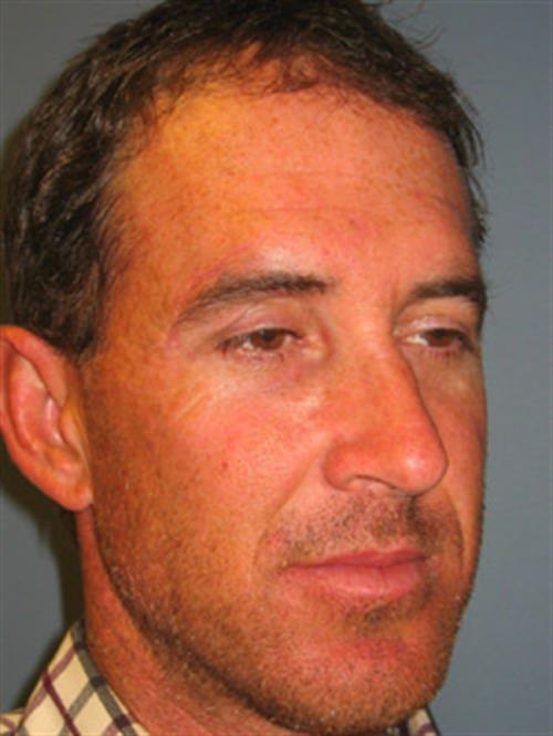 Facial & Body Reconstruction After Photo | Phoenix and Scottsdale, AZ | Scottsdale Center for Plastic Surgery