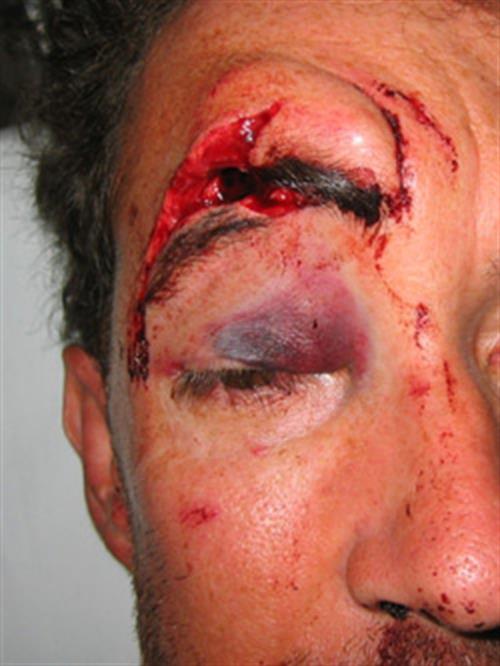Facial & Body Reconstruction Before Photo | Phoenix and Scottsdale, AZ | Scottsdale Center for Plastic Surgery