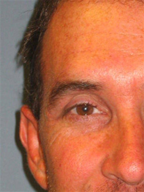 Facial & Body Reconstruction After Photo | Phoenix and Scottsdale, AZ | Scottsdale Center for Plastic Surgery