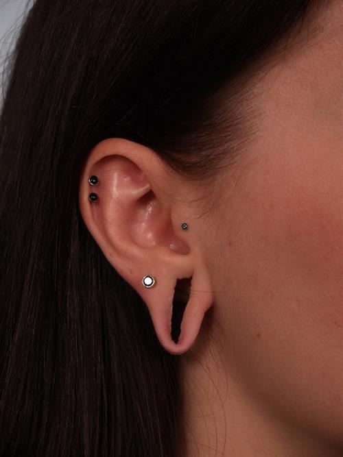 Otoplasty (Ear Reshaping) Before Photo | Phoenix and Scottsdale, AZ | Scottsdale Center for Plastic Surgery