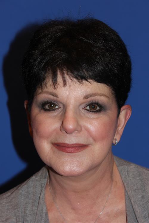 Facelift/Necklift After Photo | Phoenix and Scottsdale, AZ | Scottsdale Center for Plastic Surgery