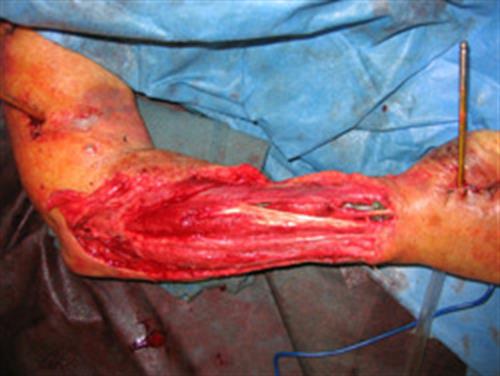 Facial & Body Reconstruction Before Photo | Phoenix and Scottsdale, AZ | Scottsdale Center for Plastic Surgery