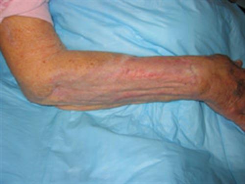 Facial & Body Reconstruction After Photo | Phoenix and Scottsdale, AZ | Scottsdale Center for Plastic Surgery