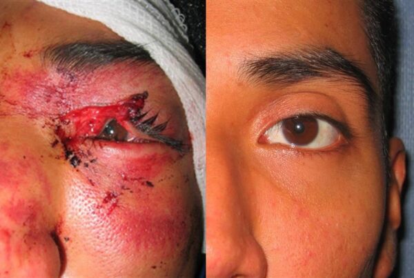 Facial & Body Reconstruction 1