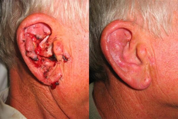 Facial & Body Reconstruction 4