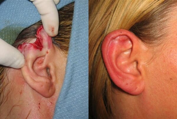 Facial & Body Reconstruction 5