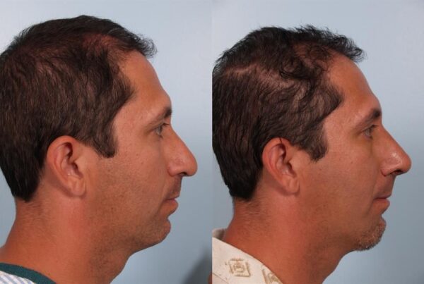 Facial Surgery 2